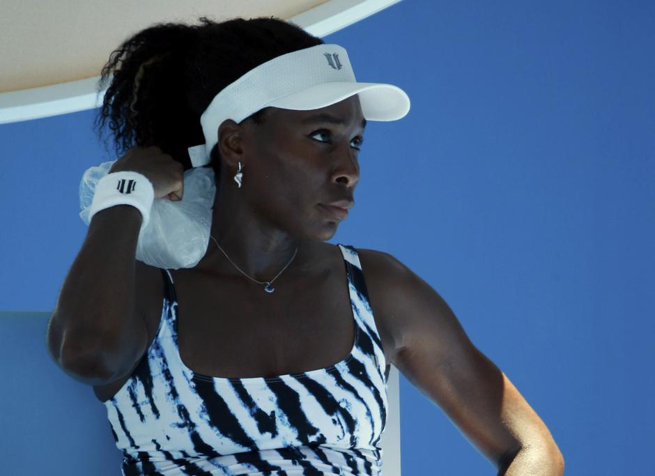 Venus Williams
