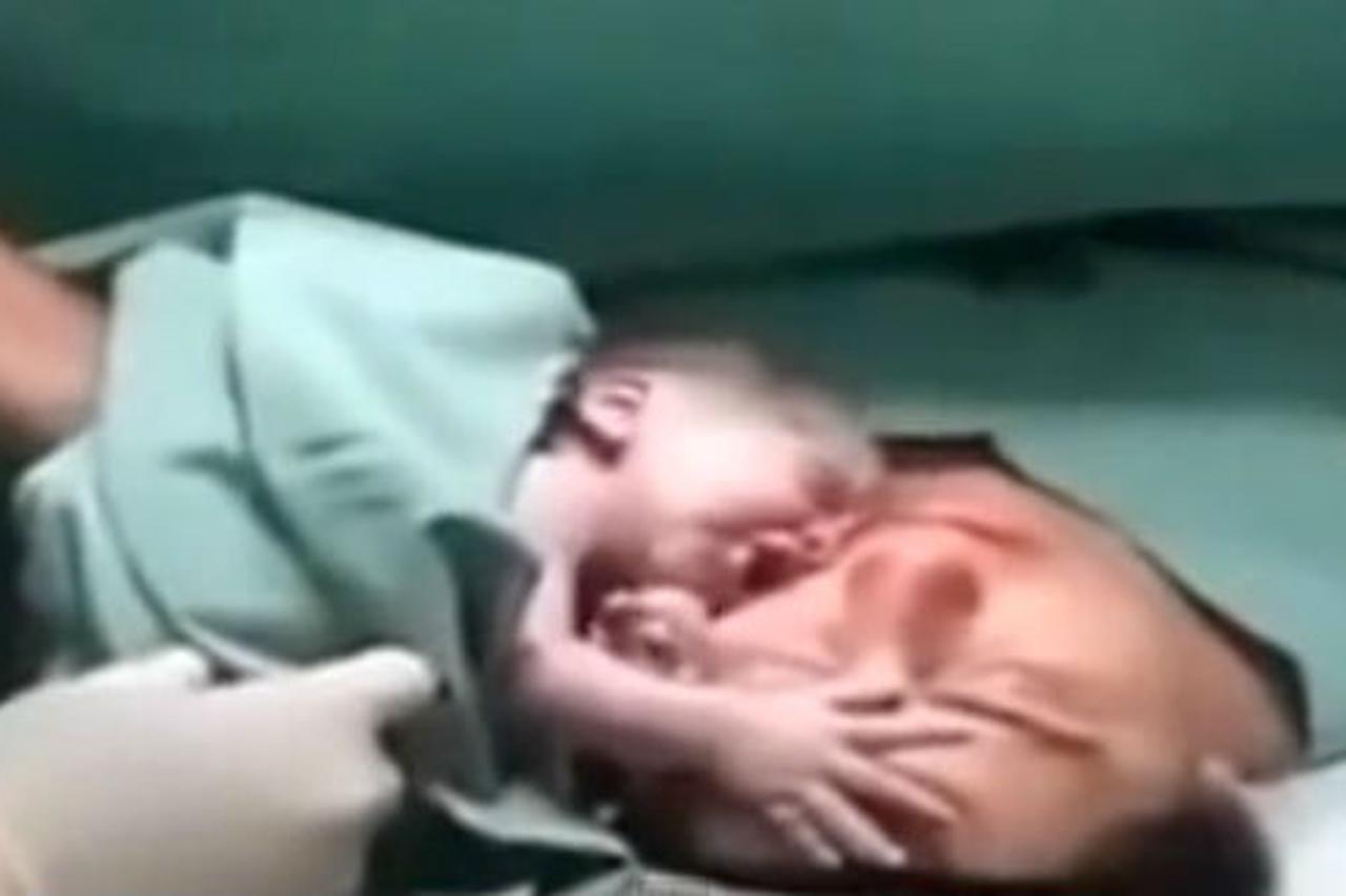 Tek rođena beba nije se dala odvojiti od mame