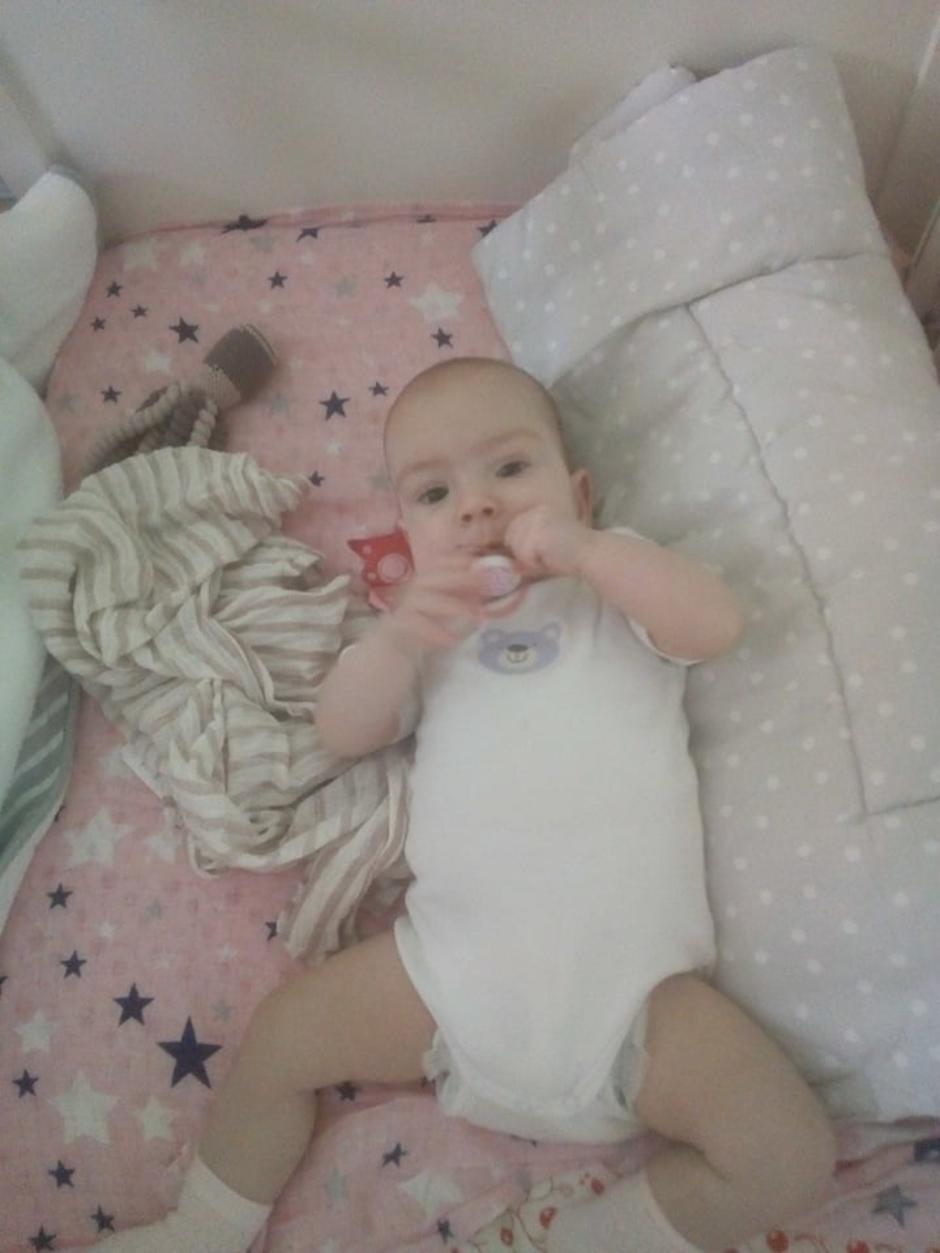 Razdvojene sijamske blizanke Valentina i Kristina Tambolaš