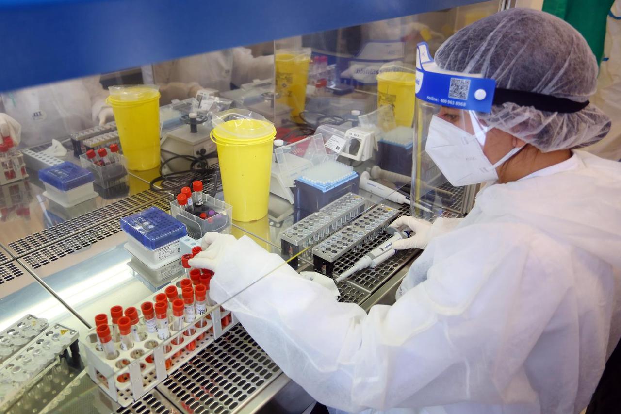 Karlovački epidemiolozi dnevno obrade preko 200 testova na koronavirus