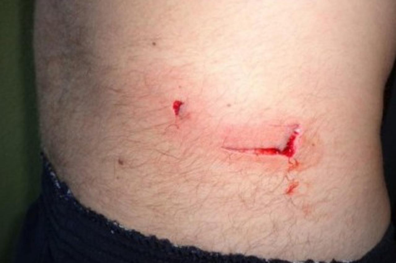 dabar,napad,krunoslav zovko (1)