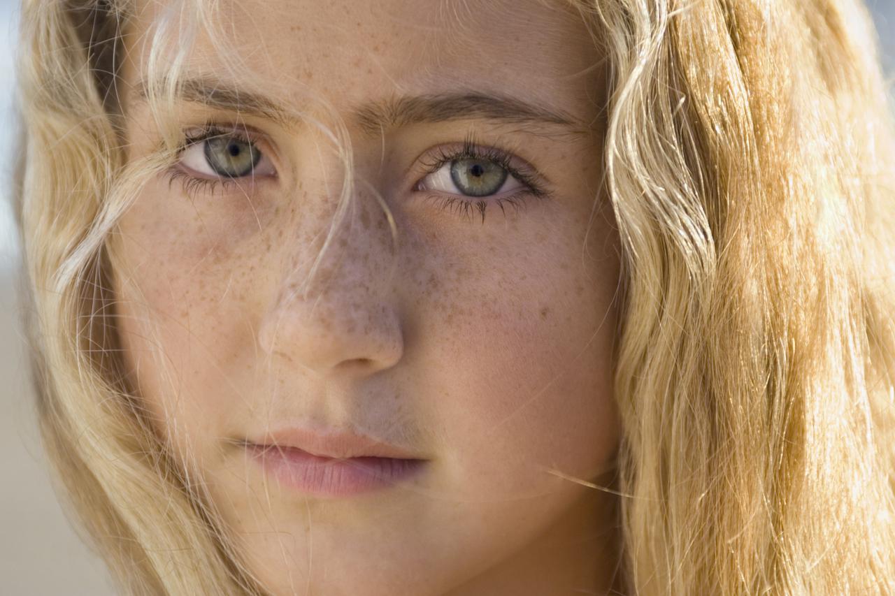 Žena s pjegicama, pjegice