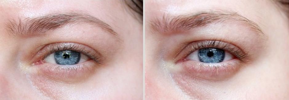 Lux-Factor serum za rast trepavica