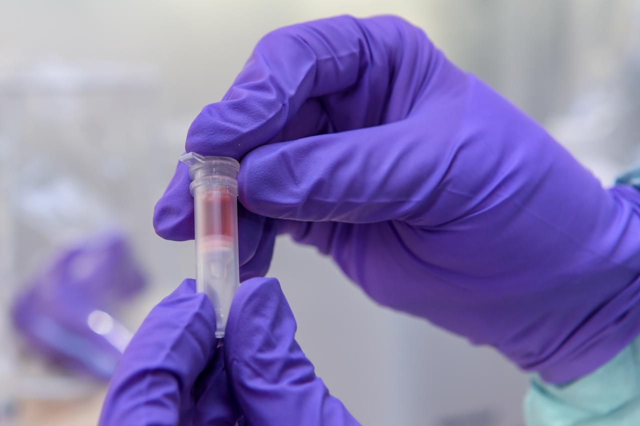 Hamburg: Mobilni laboratorij (EMLab) na Bernhard Nocht institutu za tropsku medicinu