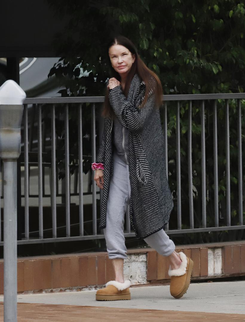 Bivši supermodel Janice Dickinson ne pojavljuje se često u javnosti, ali paparazzi su je sada snimili dok je bila u šetnji Los Angelesom.