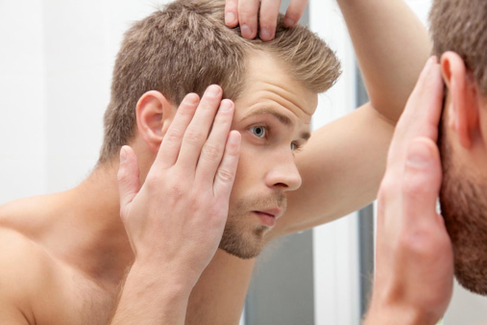Gubitak kose - Slabija kosa, ispadanje... Još su neki od pokazatelja hormonalnih poremećaja. 