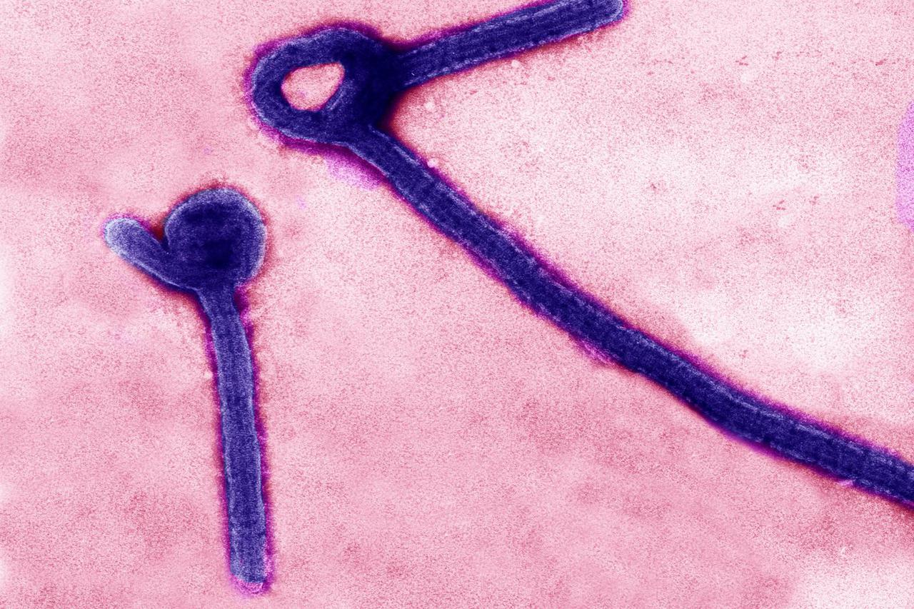 FILE PHOTO: A transmission electron micrograph shows Ebola virus particles in this undated handout image released by the USAMRIID in Fredrick, Maryland