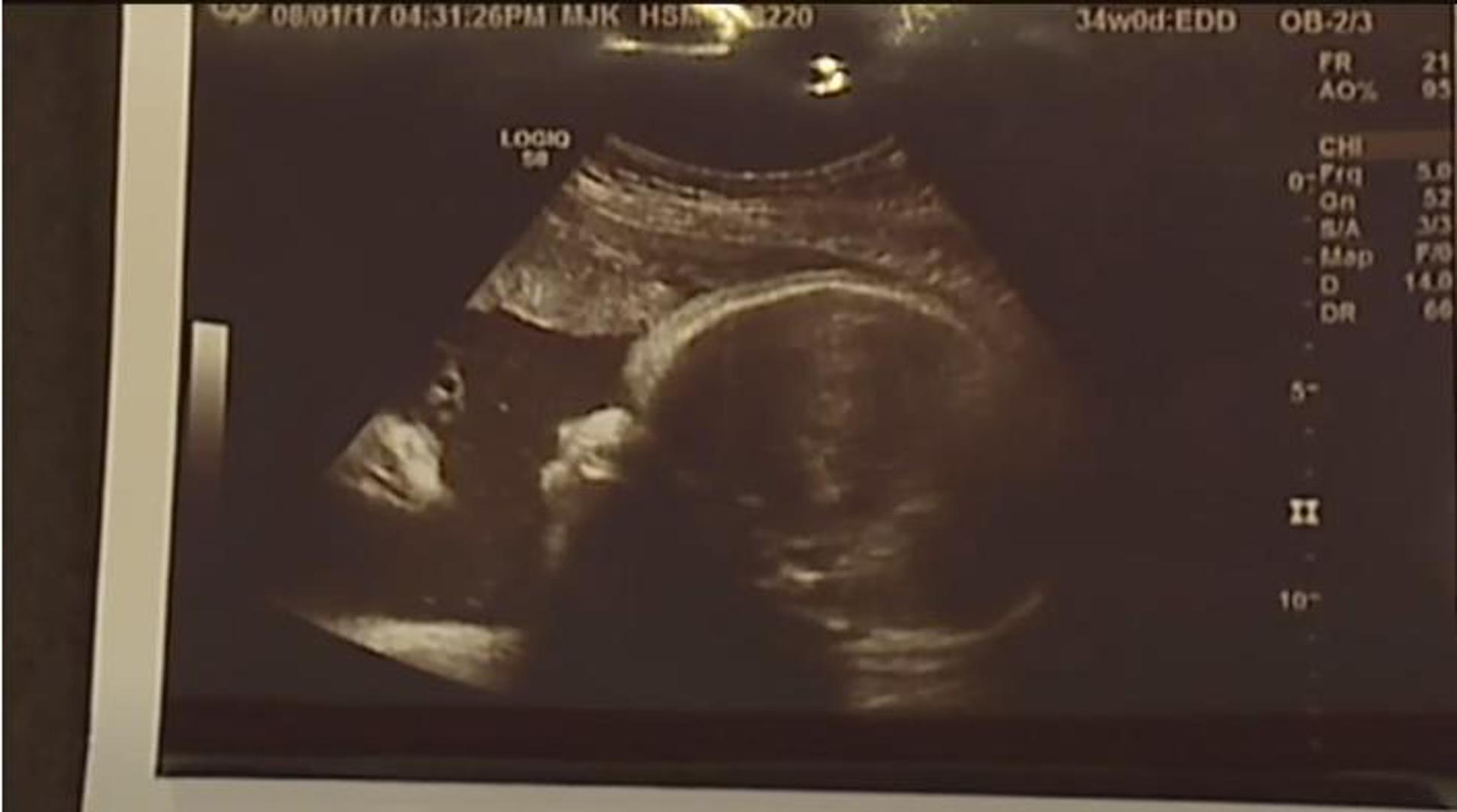 Kada su Alicia Zeek i Zac Smith vidjeli fotografiju s ultrazvuka svoje nerođene kćeri, znali su da je to Božji znak. Kraj lica bebe u kutu fotografije nalazilo se još jedno lice, a roditelji tvrde kako je riječ o Isusu koji gleda u njihovo dijete. Par kaže kako nisu pretjerano religiozni, ali da im je ova fotografija dala nadu jer im je prethodno dvoje djece rođeno s malformacijama.