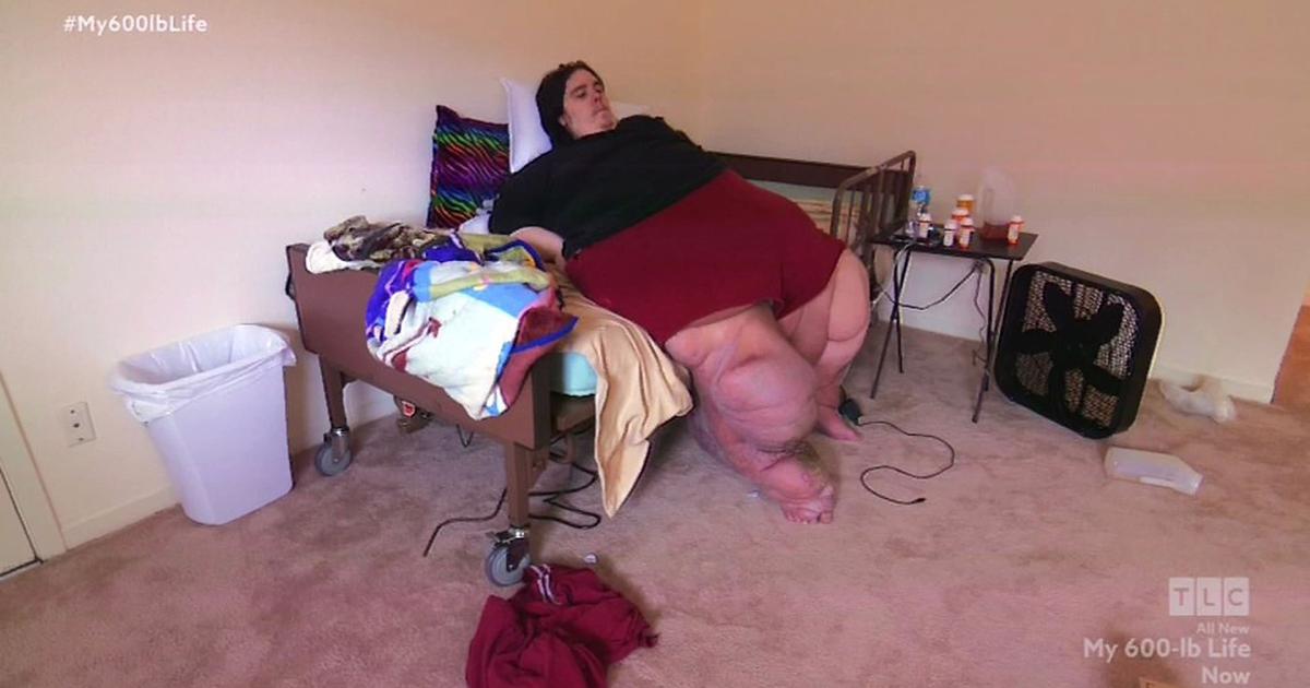 Najgori pacijent s 363 kilograma: Prolijevao urin po bolnici, zlostavljao doktore i uništio brata